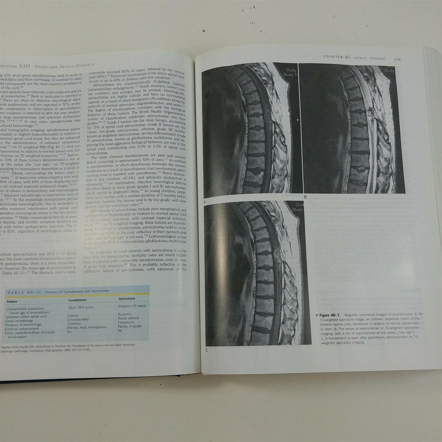 Neurology and Clinical Neuroscience by Anthony Schapira + Supplemental CD